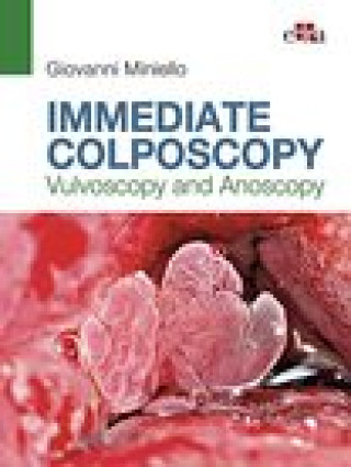 Kniha Immediate Colposcopy - Vulvoscopy and Anoscopy MINIELLO