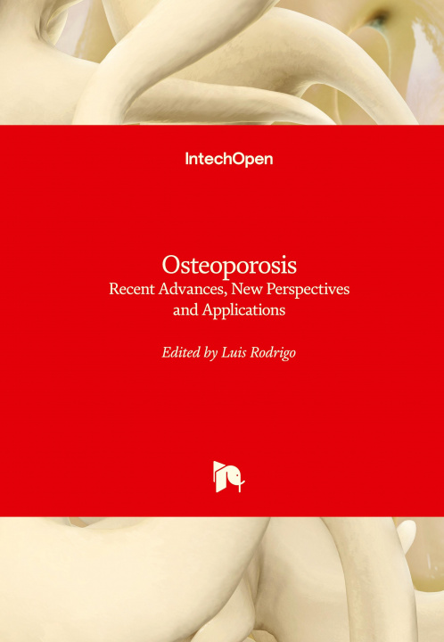Knjiga Osteoporosis Luis Rodrigo