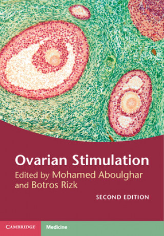 Kniha Ovarian Stimulation Botros Rizk