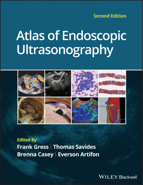 Carte Atlas of Endoscopic Ultrasonography 2e Frank G. Gress