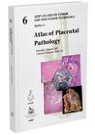 Könyv Atlas of Placental Pathology Drucilla J. Roberts