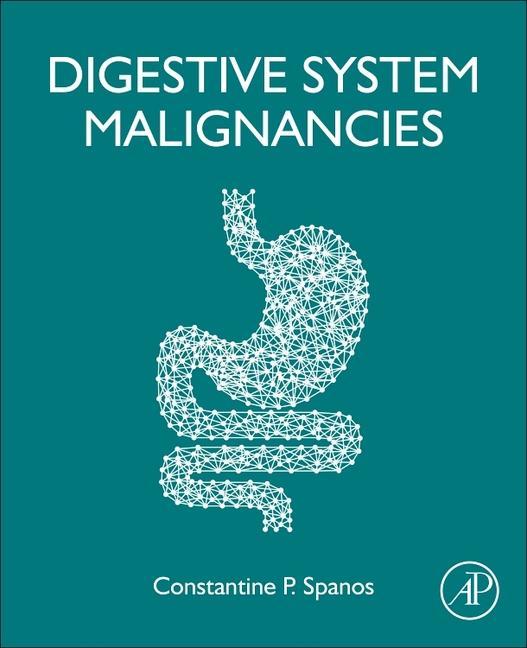 Knjiga Digestive System Malignancies Constantine P. Spanos