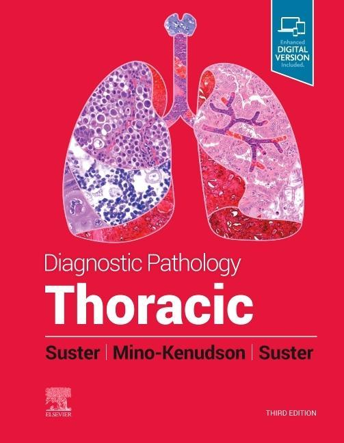 Carte Diagnostic Pathology: Thoracic Saul Suster