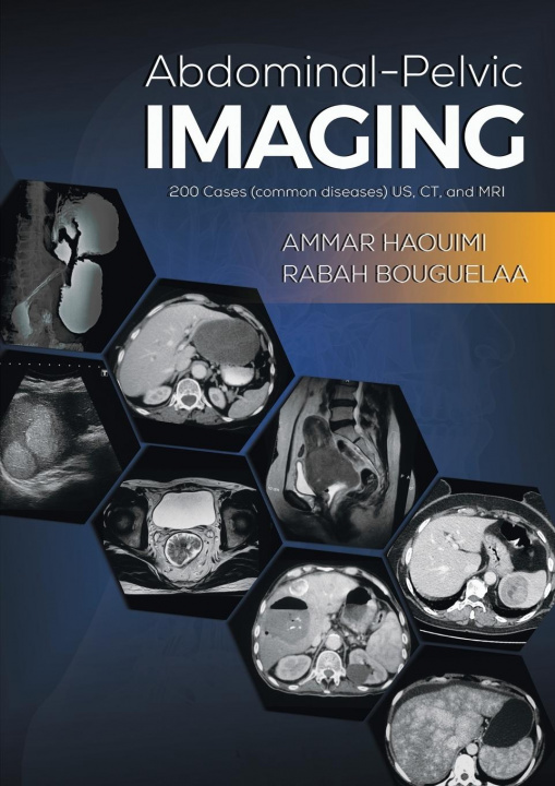 Kniha Abdominal-Pelvic Imaging Ammar Haouimi