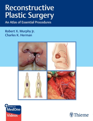 Buch Reconstructive Plastic Surgery Charles Herman