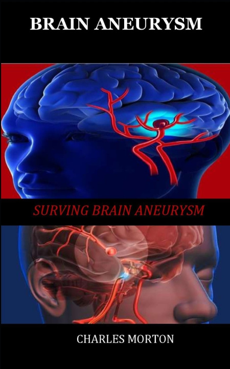 Knjiga Brain Aneurysm MORTON CHARLES MORTON