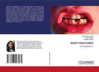 Knjiga ROOT FRACTURES Sarita Singh