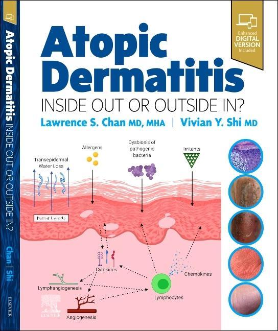 Kniha Atopic Dermatitis: Inside Out or Outside In Lawrence S Chan