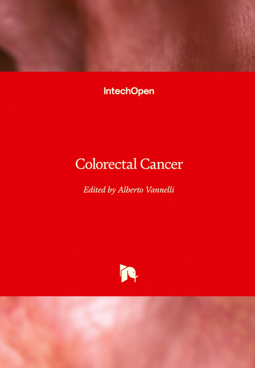 Carte Colorectal Cancer 