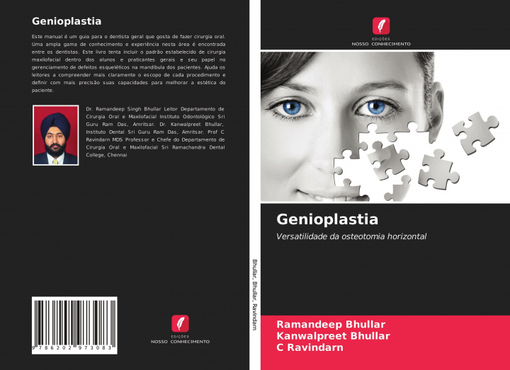 Carte Genioplastia Kanwalpreet Bhullar