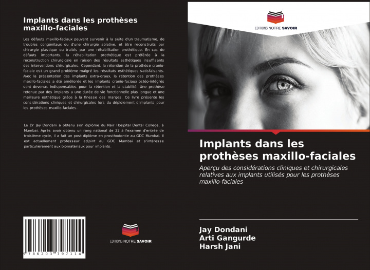 Carte Implants dans les proth?ses maxillo-faciales Arti Gangurde