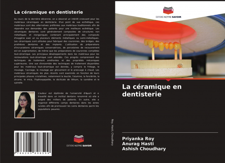 Carte La céramique en dentisterie Anurag Hasti