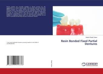 Kniha Resin Bonded Fixed Partial Dentures 