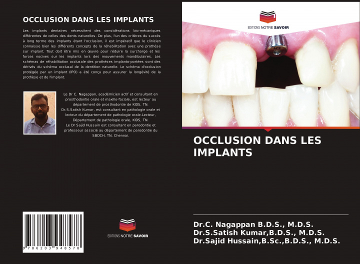 Knjiga Occlusion Dans Les Implants B. D. S. Kumar