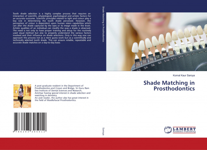 Knjiga Shade Matching in Prosthodontics KOMAL KAUR SAROYA