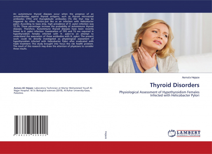 Kniha Thyroid Disorders ASMA'A HEJAZE