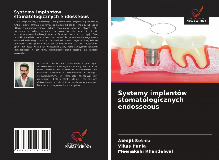 Книга Systemy implantow stomatologicznych endosseous Vikas Punia