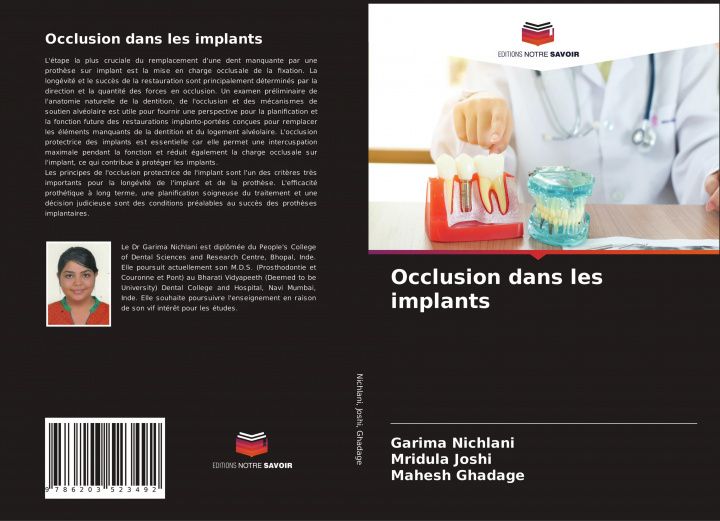 Knjiga Occlusion dans les implants Mridula Joshi