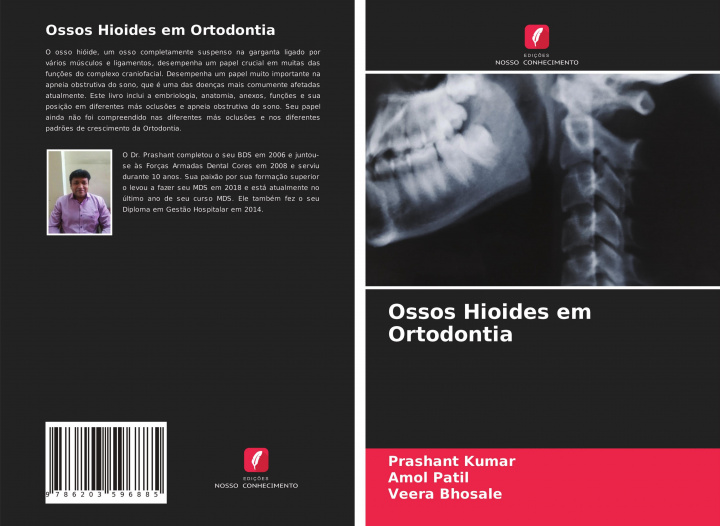 Könyv Ossos Hioides em Ortodontia Amol Patil
