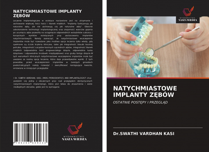 Könyv Natychmiastowe Implanty Z&#280;bow 