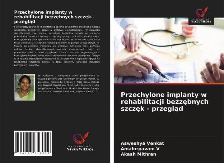 Könyv Przechylone implanty w rehabilitacji bezz&#281;bnych szcz&#281;k - przegl&#261;d Amalorpavam V