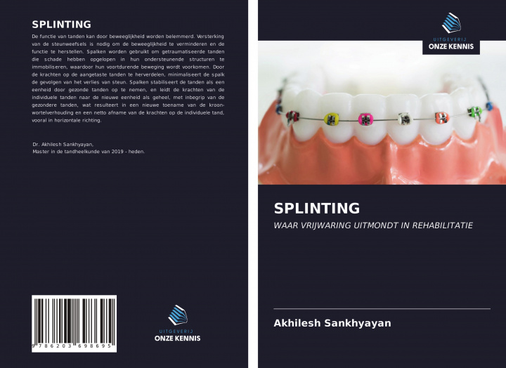 Knjiga SPLINTING Akhilesh Sankhyayan