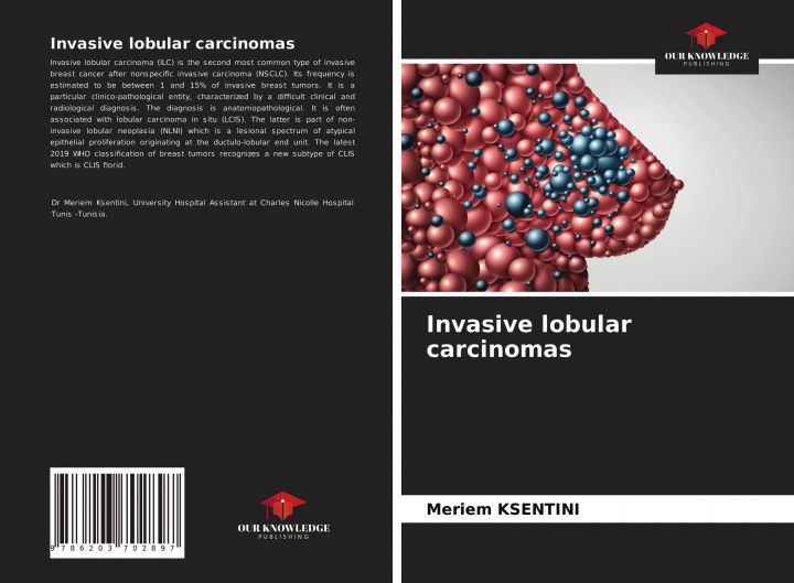 Knjiga Invasive lobular carcinomas Meriem KSENTINI