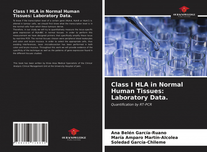 Carte Class I HLA in Normal Human Tissues: Laboratory Data. María Amparo Martín-Alcolea