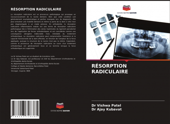 Boek RÉSORPTION RADICULAIRE Ajay Kubavat