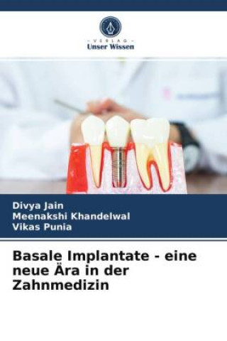 Kniha Basale Implantate - eine neue Ära in der Zahnmedizin Meenakshi Khandelwal