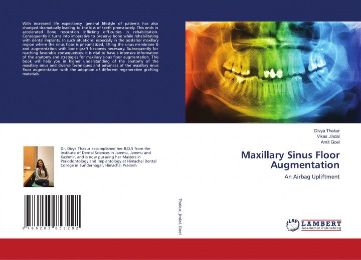 Βιβλίο Maxillary Sinus Floor Augmentation Vikas Jindal