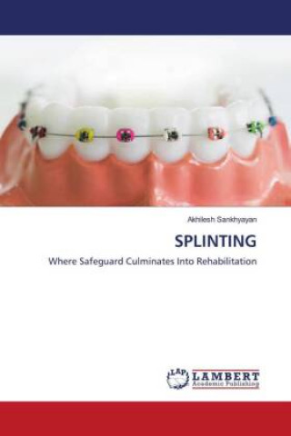 Knjiga SPLINTING Akhilesh Sankhyayan