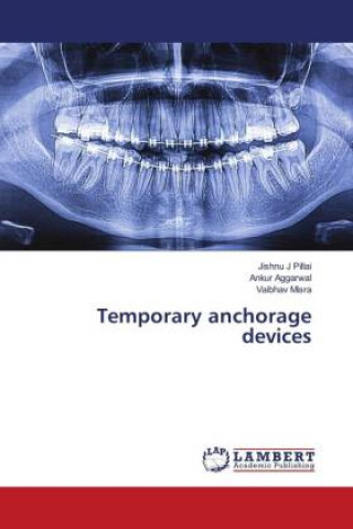 Knjiga Temporary anchorage devices Ankur Aggarwal