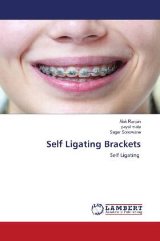 Knjiga Self Ligating Brackets Payal Mate