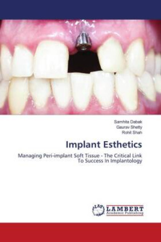 Knjiga Implant Esthetics Gaurav Shetty