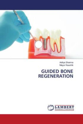 Книга GUIDED BONE REGENERATION Mayur Kaushik