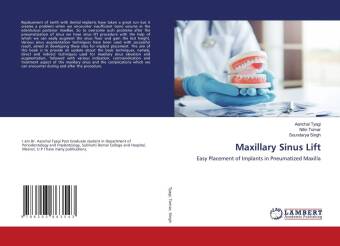 Book Maxillary Sinus Lift Nitin Tomar