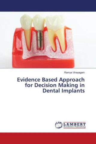 Knjiga Evidence Based Approach for Decision Making in Dental Implants Ramya Vinayagam