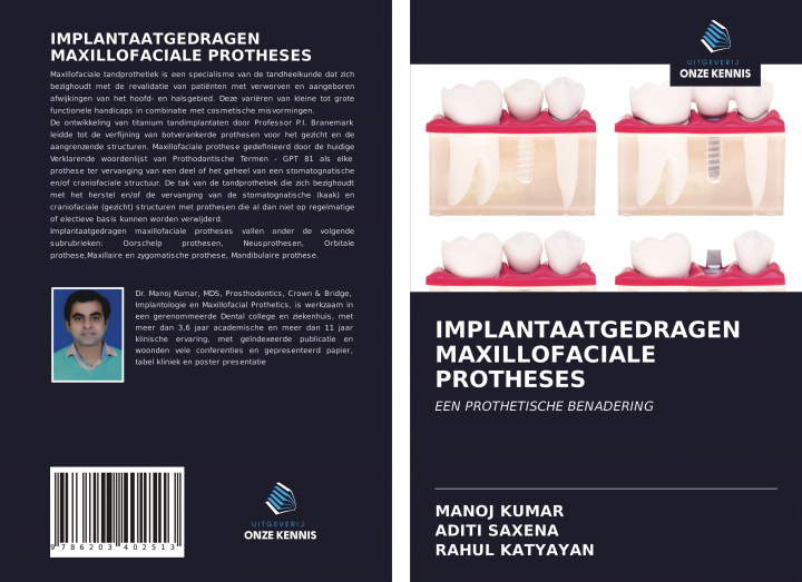 Buch IMPLANTAATGEDRAGEN MAXILLOFACIALE PROTHESES Aditi Saxena