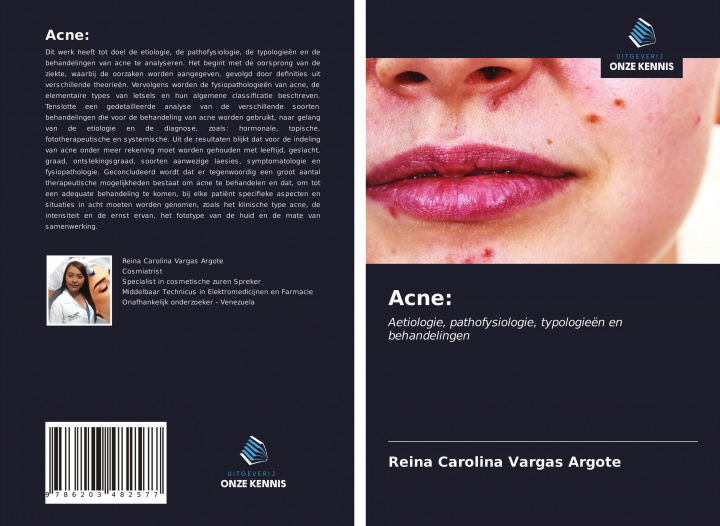 Knjiga Acne: 