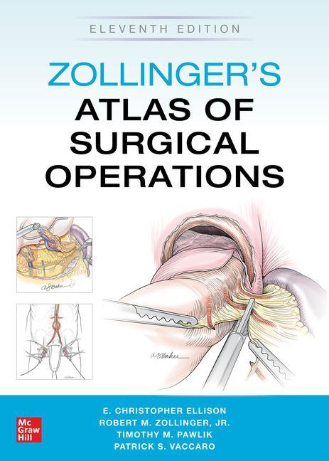 Book Zollinger's Atlas of Surgical Operations, Eleventh Edition E. Ellison