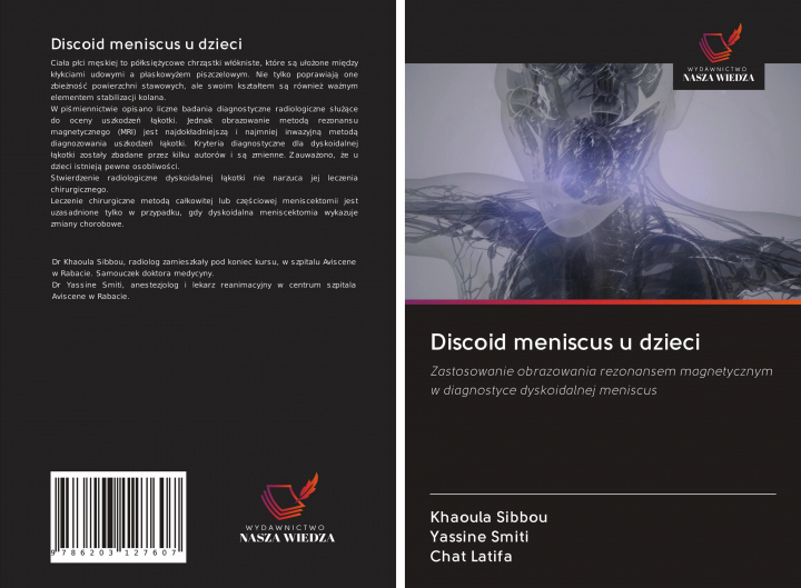Книга Discoid meniscus u dzieci Yassine Smiti
