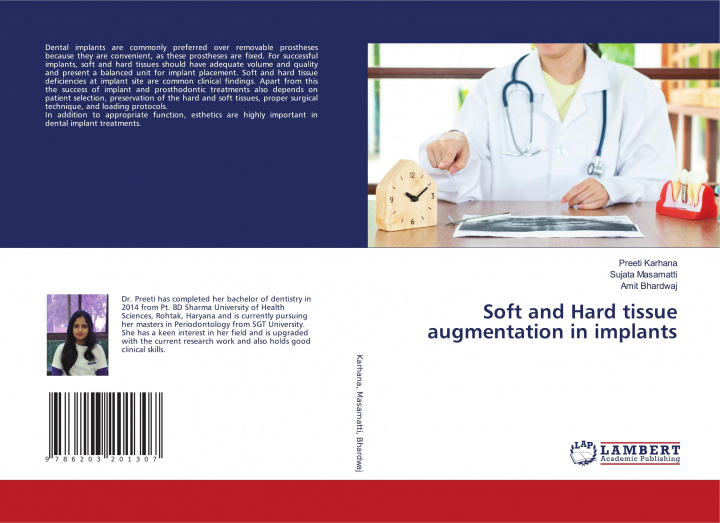 Kniha Soft and Hard tissue augmentation in implants Sujata Masamatti