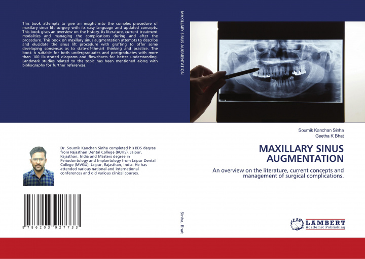 Book MAXILLARY SINUS AUGMENTATION Geetha K Bhat