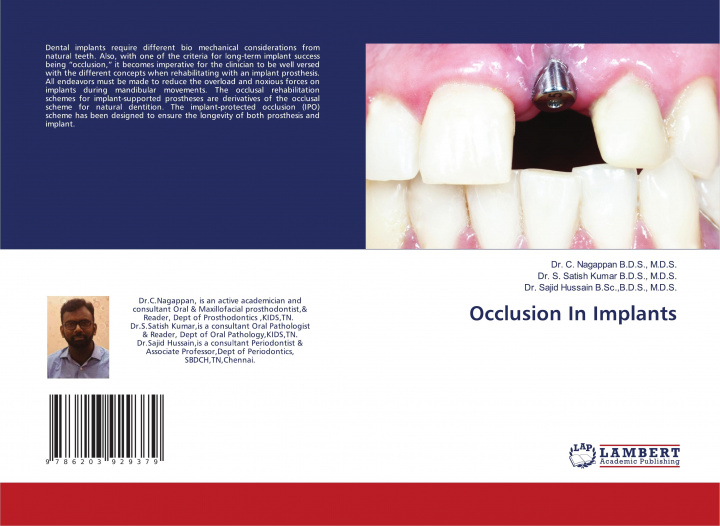 Knjiga Occlusion In Implants M. D. S. Kumar B. D. S.