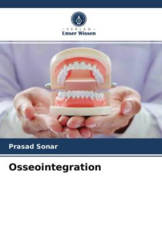 Knjiga Osseointegration Prasad Sonar