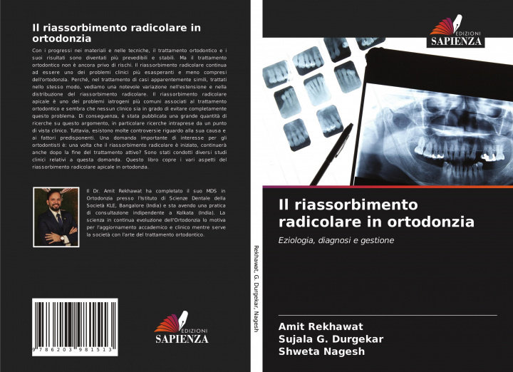 Boek Il riassorbimento radicolare in ortodonzia Sujala G. Durgekar