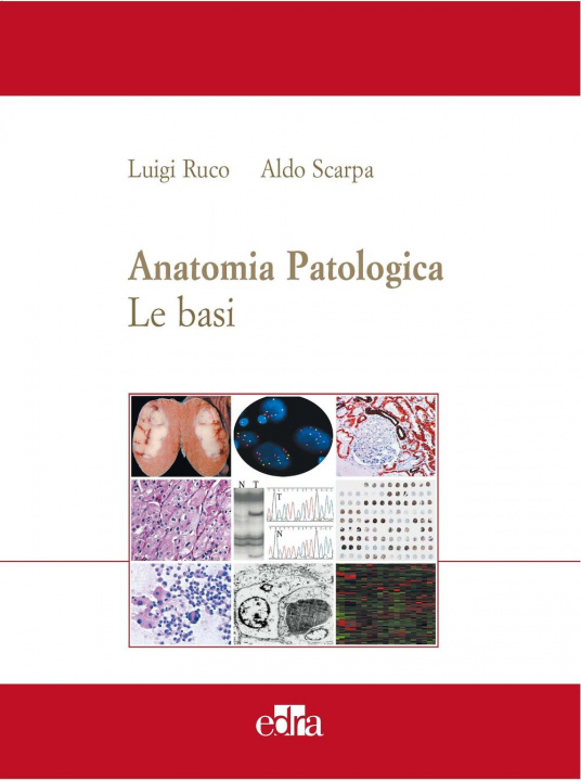 Kniha Anatomia patologica. Le basi Aldo Scarpa