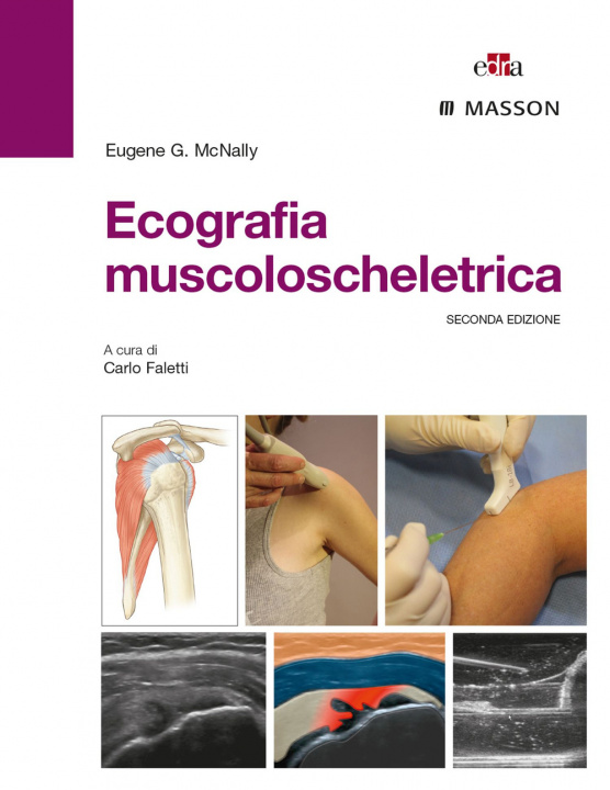 Kniha Ecografia muscoloscheletrica Eugene G. McNally