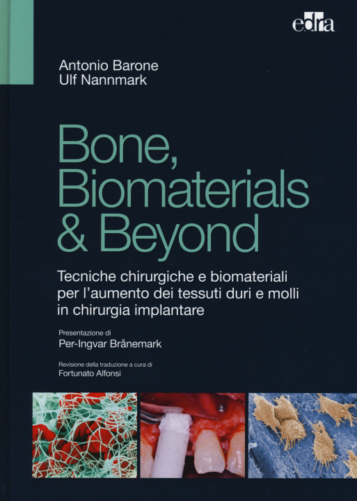 Carte Bone, biomaterials & beyond. Tecniche chirurgiche e biomateriali per l'aumento dei tessuti duri e molli in chirurgia implantare Antonio Barone